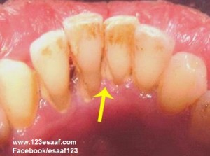 www.123esaaf.com