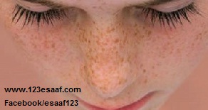 www.123esaaf.com