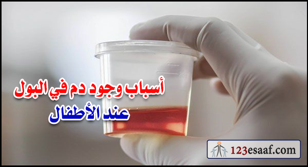 أسباب وجود دم في البول عند الأطفال