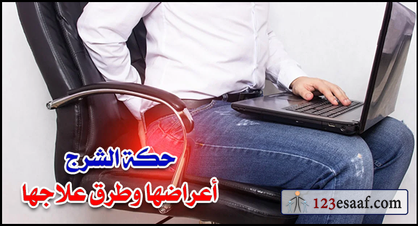 حكة الشرج أعراضها وطرق علاجها