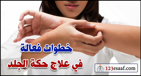 خطوات فعالة في علاج حكة الجلد