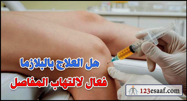 هل العلاج بالبلازما فعال لالتهاب المفاصل