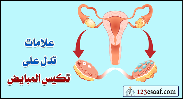 علامات تدل على تكيس المبايض