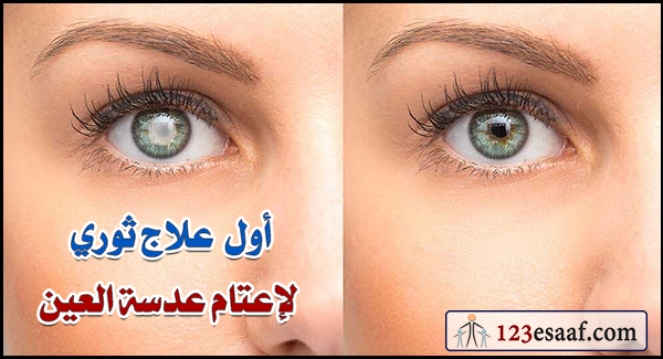 أول علاج ثوري لإعتام عدسة العين