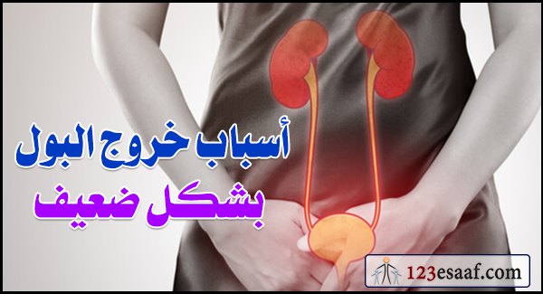 أسباب خروج البول بشكل ضعيف