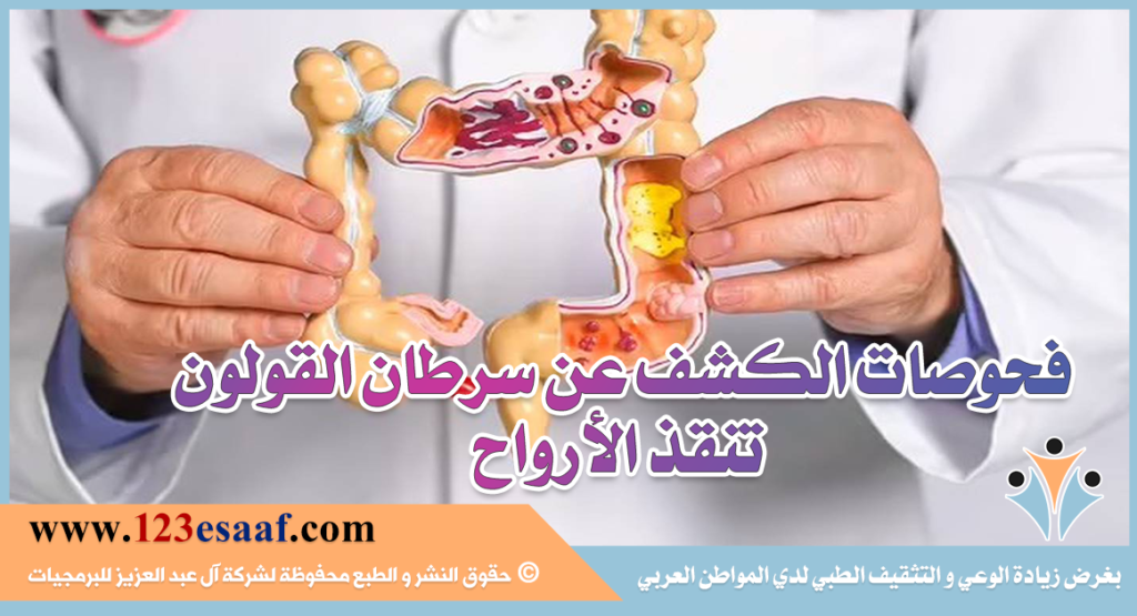 فحوصات الكشف عن سرطان القولون تنقذ الأرواح