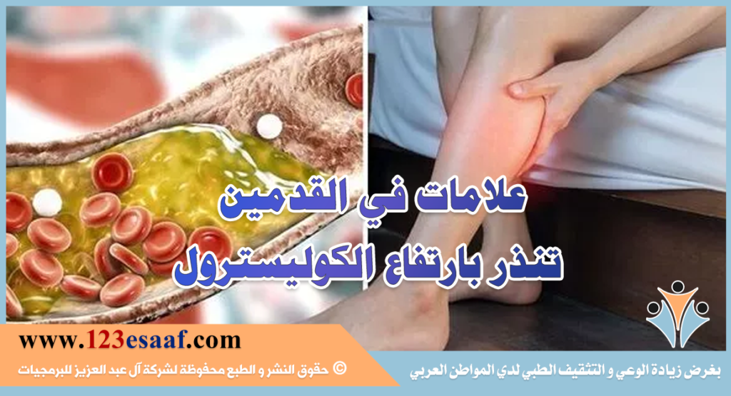 علامات في القدمين تنذر بارتفاع الكوليسترول