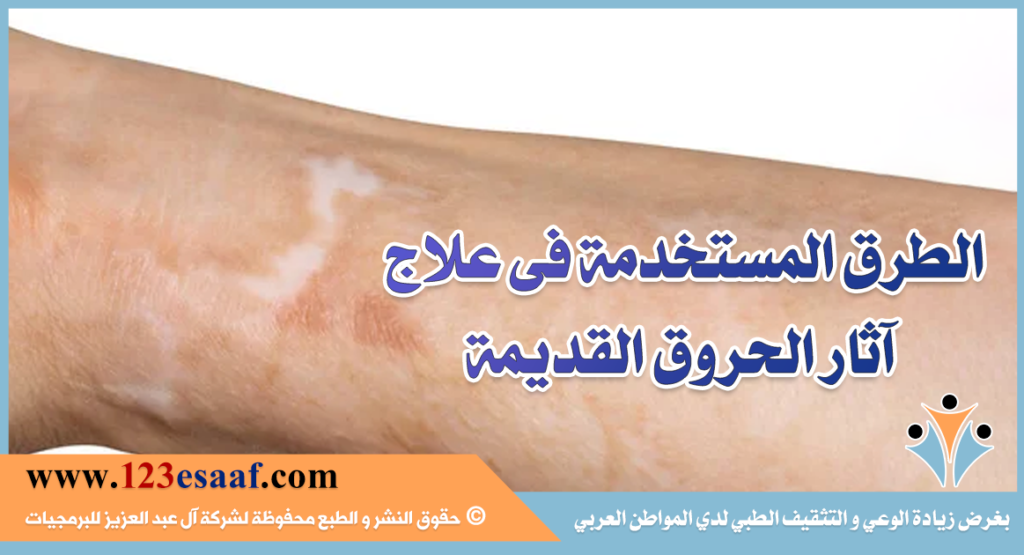 الطرق المستخدمة فى علاج آثار الحروق القديمة