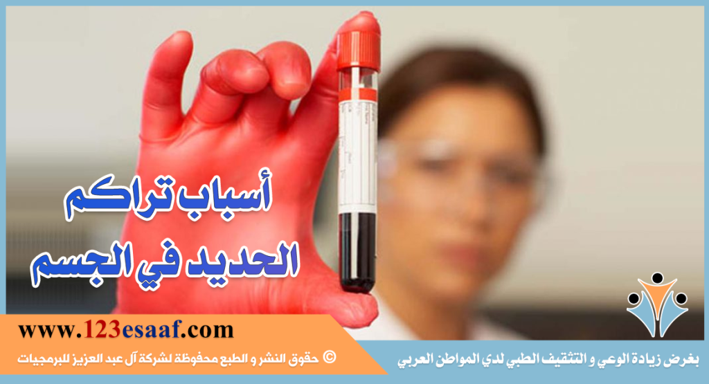 أسباب تراكم الحديد في الجسم