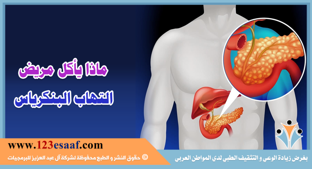 ماذا يأكل مريض التهاب البنكرياس