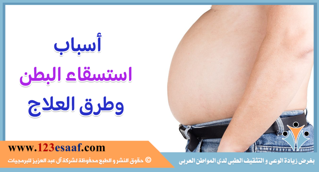 أسباب استسقاء البطن وطرق العلاج