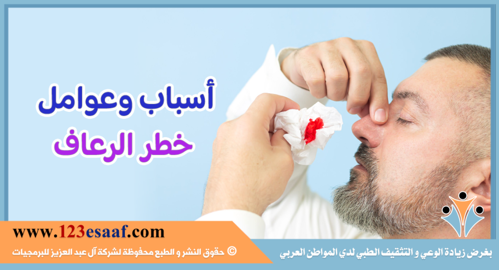 أسباب وعوامل خطر الرعاف