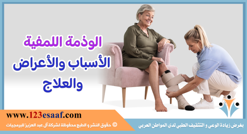 الوذمة اللمفية الأسباب والأعراض والعلاج