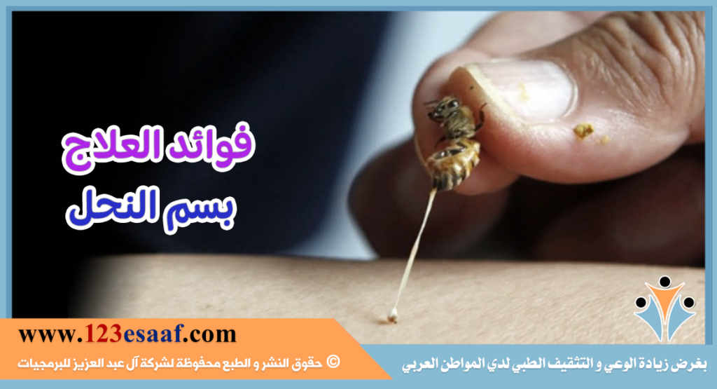 فوائد العلاج بسم النحل