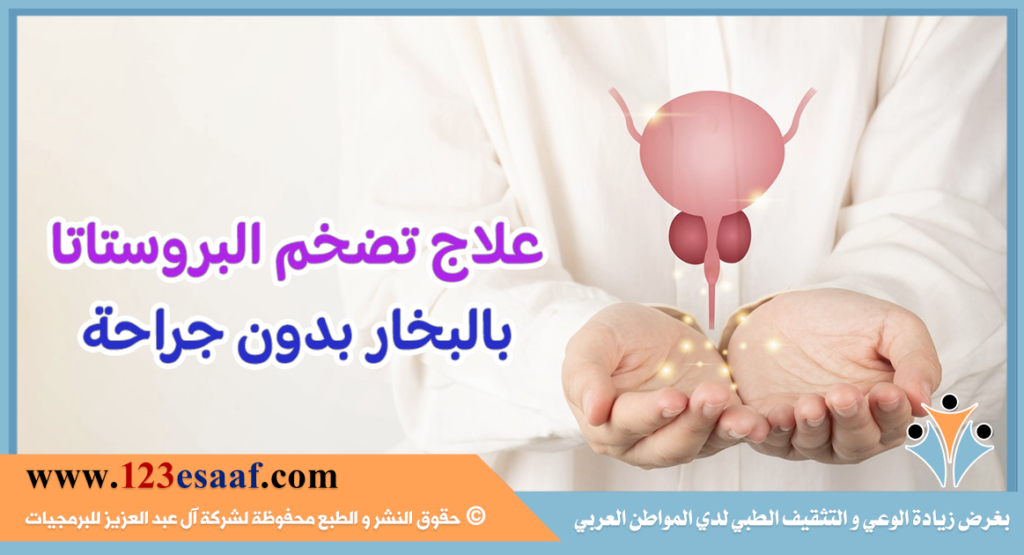 علاج تضخم البروستاتا بالبخار بدون جراحة