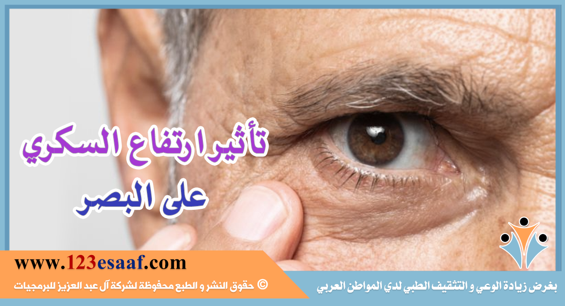 تأثير ارتفاع السكري على البصر