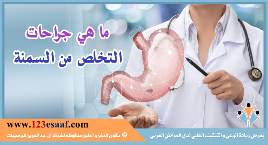 ما هي جراحات التخلص من السمنة