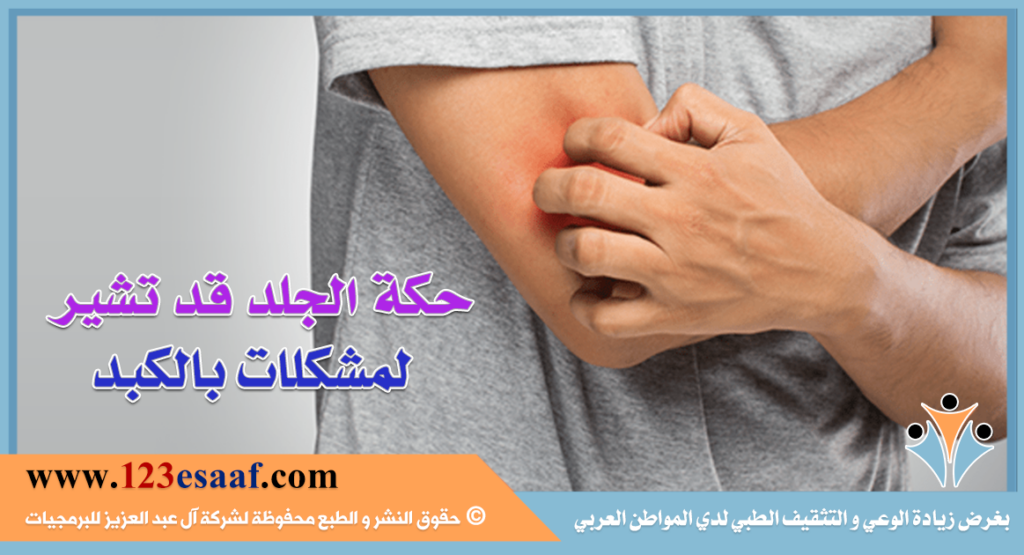 حكة الجلد قد تشير لمشكلات بالكبد