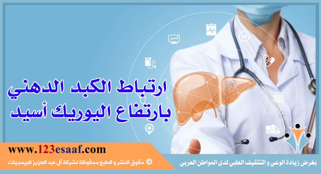 ارتباط الكبد الدهني بارتفاع اليوريك أسيد