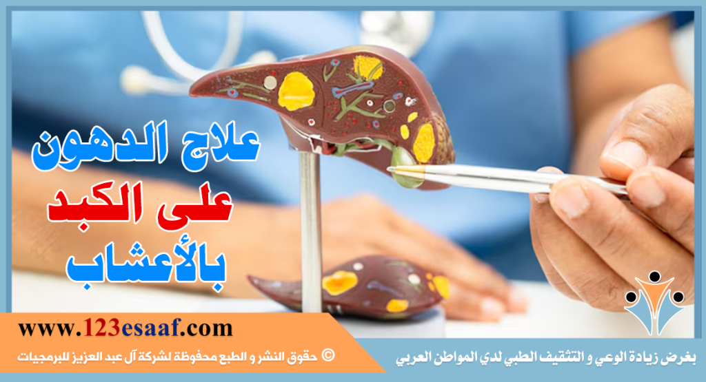 علاج الدهون على الكبد بالأعشاب