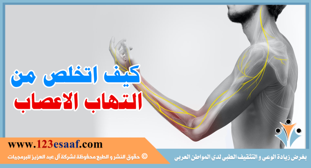 كيف اتخلص من التهاب الاعصاب