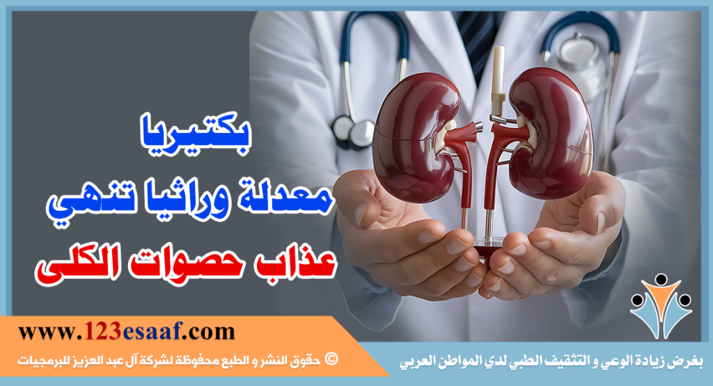بكتيريا معدلة وراثيا تنهي عذاب حصوات الكلى