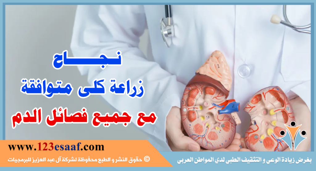 نجاح زراعة كلى متوافقة مع جميع فصائل الدم