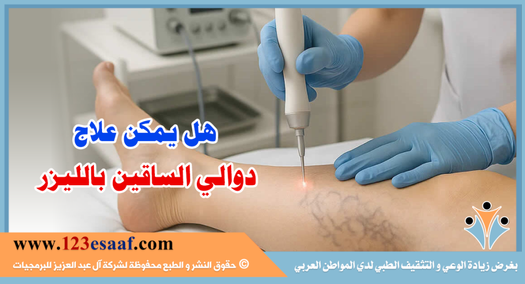 هل يمكن علاج دوالي الساقين بالليزر