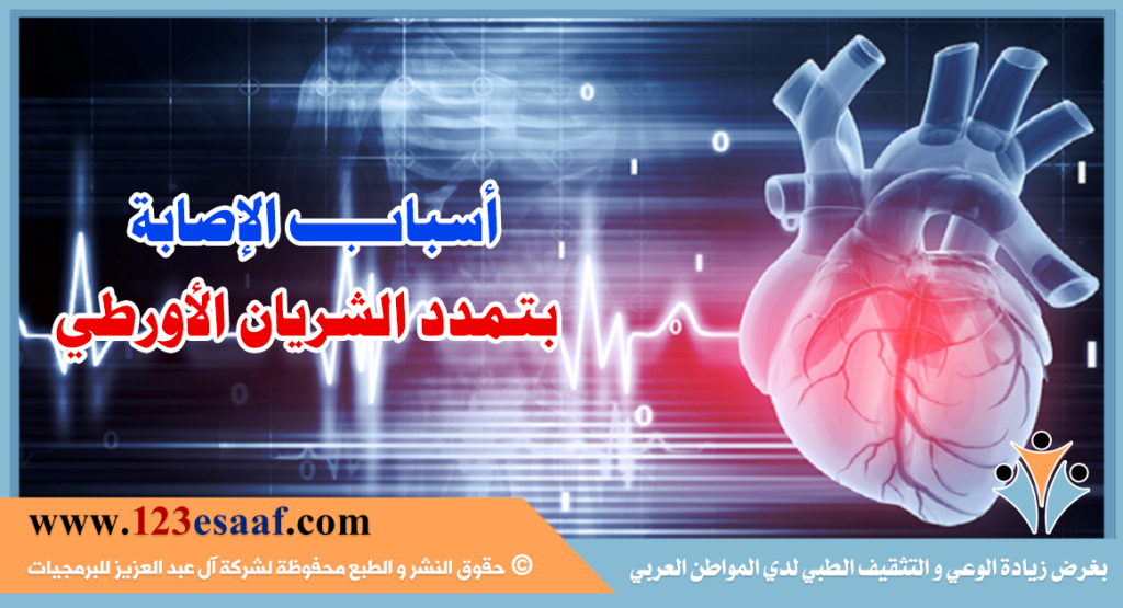 أسباب الإصابة بتمدد الشريان الأورطي