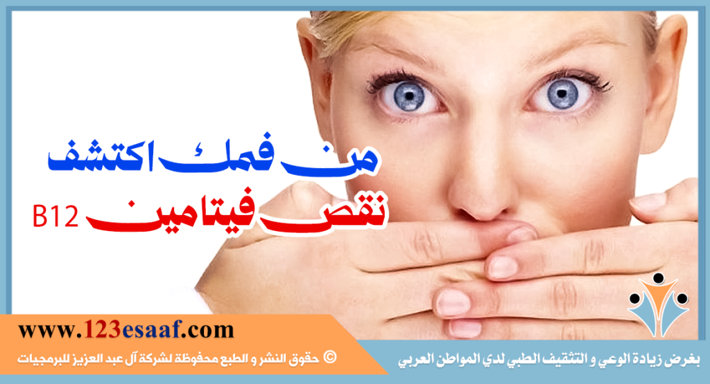 من فمك اكتشف نقص فيتامين B12