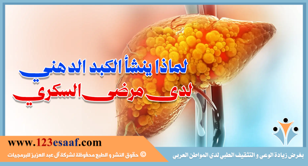 لماذا ينشأ الكبد الدهني لدى مرضى السكري