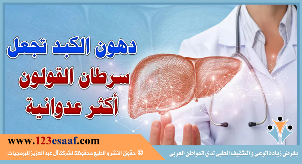 دهون الكبد تجعل سرطان القولون أكثر عدوانية