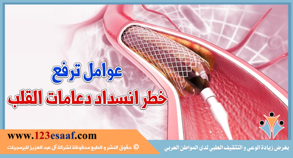 عوامل ترفع خطر انسداد دعامات القلب