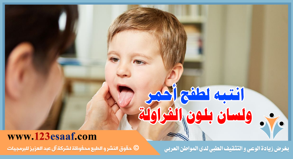 انتبه لطفح أحمر ولسان بلون الفراولة